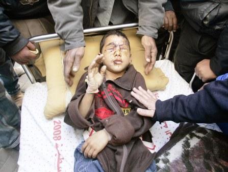 طفل فلسطيني جريح متأثرا بالقنابل الفسفورية الاسرائيلية